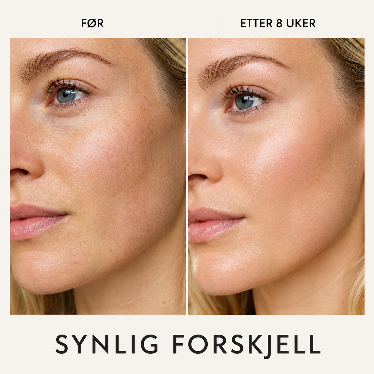Før og etter 8 uker med Essence Lift Pro