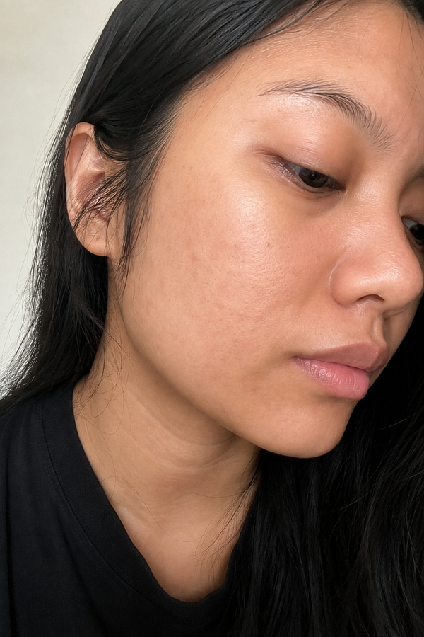 After