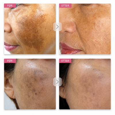Arbutin 7% Brightening Cream