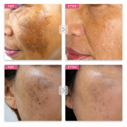 Arbutin 7% Brightening Cream