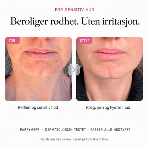 Arbutin 7% Brightening Cream