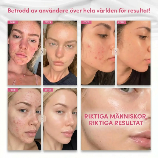 Arbutin 7% + Tranexamic Acid 4% Brightening Cream