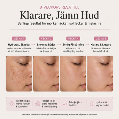 Arbutin 7% + Tranexamic Acid 4% Brightening Cream