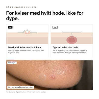 Hydrokolloid Aknelapper, fordeler
