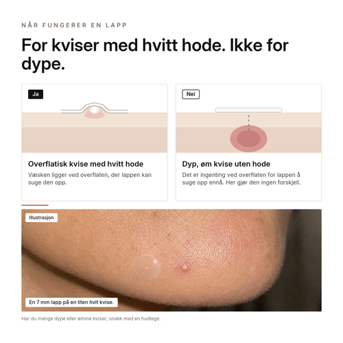 Hydrokolloid Aknelapper