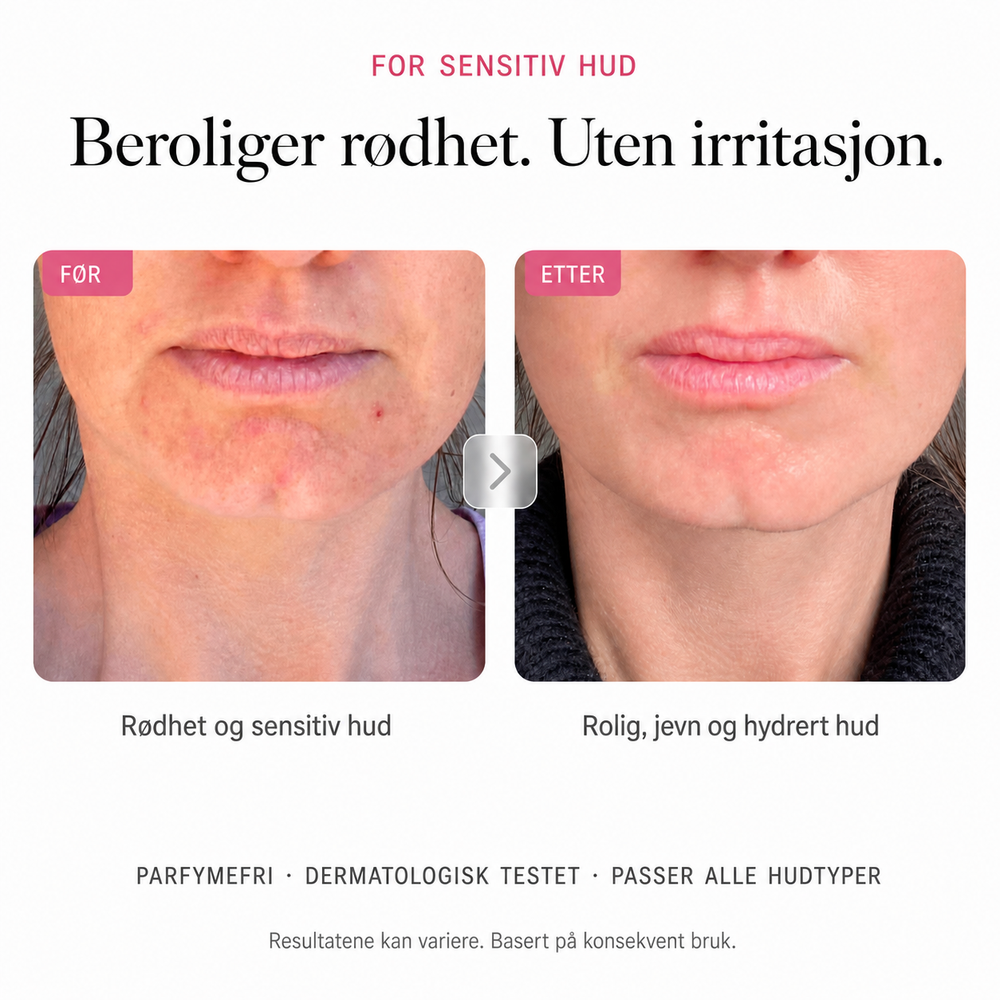 Merker & Beskyttelse