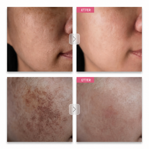 Arbutin 7% Brightening Cream