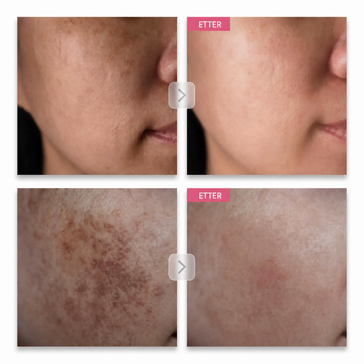 Arbutin 7% Brightening Cream