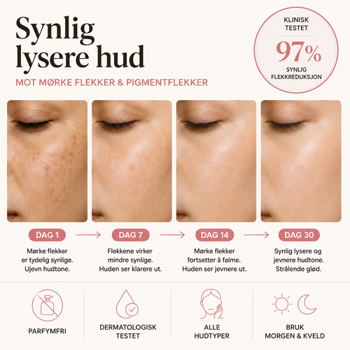 Anti-Pigment Dual Serum