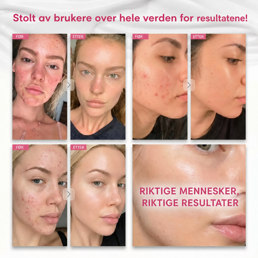 Arbutin 7% Brightening Cream