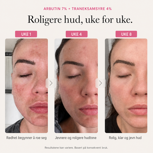 Synlige Resultater Kit