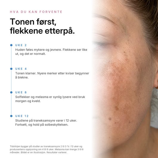 TXA Pigmentkrem, hva du kan forvente